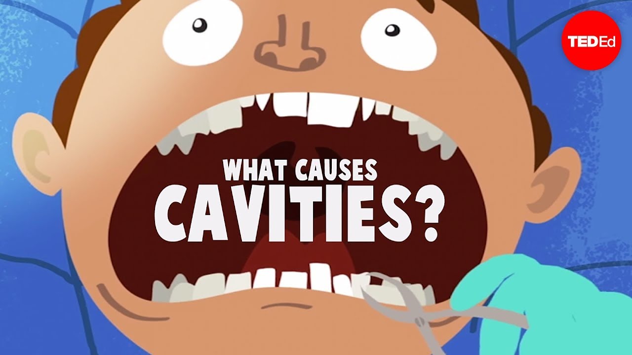 What causes cavities? – Mel Rosenberg